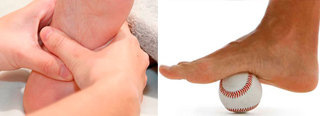 Fascitis plantar, patologís fisioterapéuticas